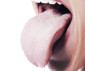 چه نوع زخمی از نشانه های سرطان دهان است؟